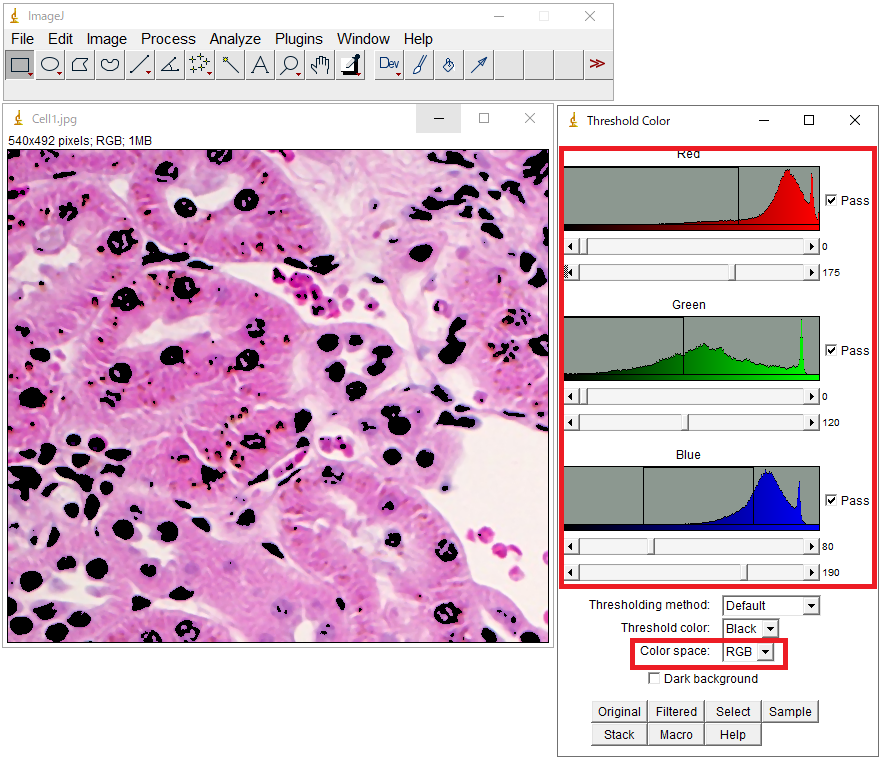 ImageJ с гистологическим изображением и окном Color Threshold